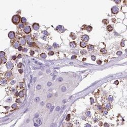 OXCT1 Polyclonal Antibody:Antibodies, Polyclonal