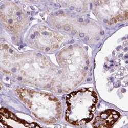 OXCT1 Polyclonal Antibody:Antibodies, Polyclonal