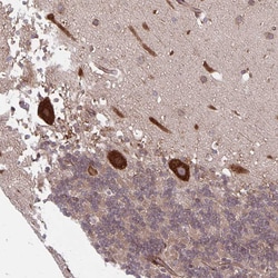 Invitrogen SEC62 Polyclonal Antibody 100 &mu;L; Unconjugated:Antibodies,