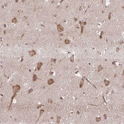 Invitrogen SEC62 Polyclonal Antibody 100 &mu;L; Unconjugated:Antibodies,