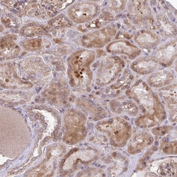 Invitrogen SEC62 Polyclonal Antibody 100 &mu;L; Unconjugated:Antibodies,