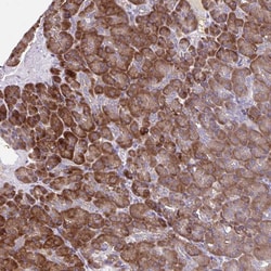 Invitrogen SEC62 Polyclonal Antibody 100 &mu;L; Unconjugated:Antibodies,