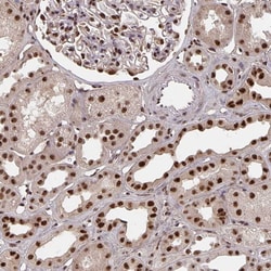 Invitrogen LAS1L Polyclonal Antibody 100 &mu;L; Unconjugated:Antibodies,