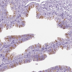 Invitrogen TTC29 Polyclonal Antibody 100 &mu;L; Unconjugated:Antibodies,
