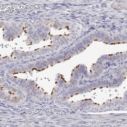 Invitrogen ENO4 Polyclonal Antibody 100 &mu;L | Buy Online | Invitrogen&trade; | Fisher Scientific