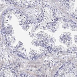 Invitrogen ENO4 Polyclonal Antibody 100 &mu;L | Buy Online | Invitrogen&trade; | Fisher Scientific