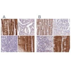 FAM168B Polyclonal Antibody:Antibodies, Polyclonal