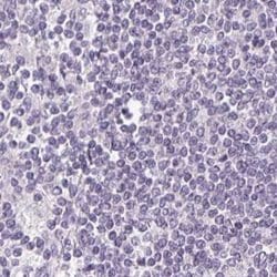 FAM168B Polyclonal Antibody:Antibodies, Polyclonal