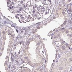 FAM168B Polyclonal Antibody:Antibodies, Polyclonal