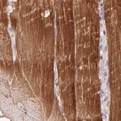 FAM168B Polyclonal Antibody:Antibodies, Polyclonal