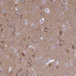 Invitrogen DYNC1I1 Polyclonal Antibody 100 &mu;L; Unconjugated:Antibodies,