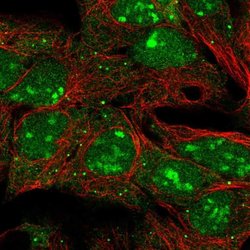 Invitrogen LIN28B Polyclonal Antibody 100 &mu;L; Unconjugated:Antibodies,
