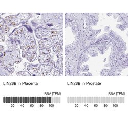Invitrogen LIN28B Polyclonal Antibody 100 &mu;L; Unconjugated:Antibodies,