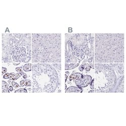 Invitrogen LIN28B Polyclonal Antibody 100 &mu;L; Unconjugated:Antibodies,