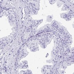 Invitrogen LIN28B Polyclonal Antibody 100 &mu;L; Unconjugated:Antibodies,
