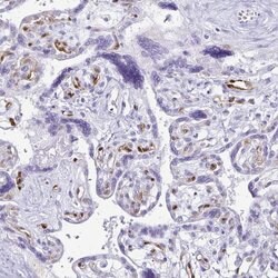Invitrogen LIN28B Polyclonal Antibody 100 &mu;L; Unconjugated:Antibodies,