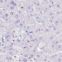 Invitrogen LIN28B Polyclonal Antibody 100 &mu;L; Unconjugated:Antibodies,