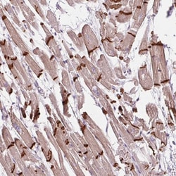 Invitrogen CTNNA3 Polyclonal Antibody 100 &mu;L; Unconjugated:Antibodies,