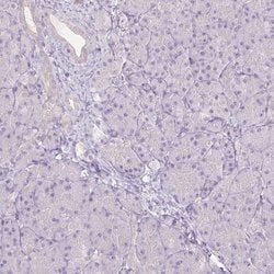 Invitrogen CTNNA3 Polyclonal Antibody 100 &mu;L; Unconjugated:Antibodies,