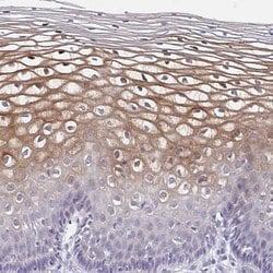 Invitrogen MRCK gamma Polyclonal Antibody 100 &mu;L; Unconjugated:Antibodies,