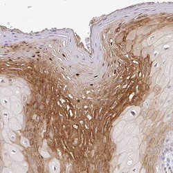 Invitrogen MRCK gamma Polyclonal Antibody 100 &mu;L; Unconjugated:Antibodies,
