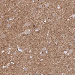 Invitrogen MRCK gamma Polyclonal Antibody 100 &mu;L; Unconjugated:Antibodies,