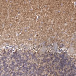 Invitrogen MRCK gamma Polyclonal Antibody 100 &mu;L; Unconjugated:Antibodies,