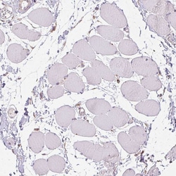 Invitrogen ADH5 Polyclonal Antibody 100 &mu;L; Unconjugated:Antibodies,