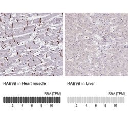 Invitrogen RAB9B Polyclonal Antibody 100 &mu;L; Unconjugated:Antibodies,