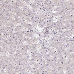 Invitrogen RAB9B Polyclonal Antibody 100 &mu;L; Unconjugated:Antibodies,