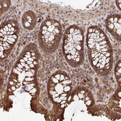 Invitrogen OR4C15 Polyclonal Antibody 100 &mu;L; Unconjugated:Antibodies,