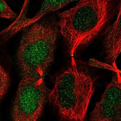 Invitrogen CHMP1B Polyclonal Antibody 100 &mu;L; Unconjugated:Antibodies,