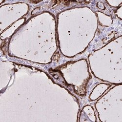 Invitrogen CHMP1B Polyclonal Antibody 100 &mu;L; Unconjugated:Antibodies,