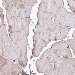 Invitrogen CHMP1B Polyclonal Antibody 100 &mu;L; Unconjugated:Antibodies,