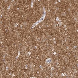 Invitrogen ATP6V1F Polyclonal Antibody 100 &mu;L; Unconjugated:Antibodies,