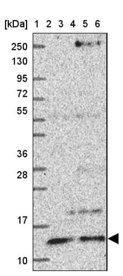 Invitrogen ATP6V1F Polyclonal Antibody 100 &mu;L; Unconjugated:Antibodies,