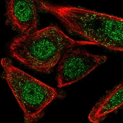 CSTF2T Polyclonal Antibody:Antibodies, Polyclonal