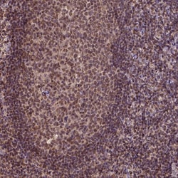 CSTF2T Polyclonal Antibody:Antibodies, Polyclonal