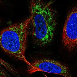 FDX1 Polyclonal Antibody:Antibodies, Polyclonal