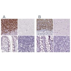 FDX1 Polyclonal Antibody:Antibodies, Polyclonal