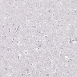 FDX1 Polyclonal Antibody:Antibodies, Polyclonal