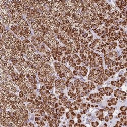 FDX1 Polyclonal Antibody:Antibodies, Polyclonal