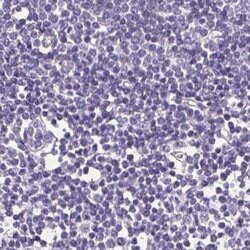 FDX1 Polyclonal Antibody:Antibodies, Polyclonal
