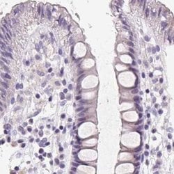 FDX1 Polyclonal Antibody:Antibodies, Polyclonal