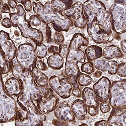 Invitrogen RCN1 Polyclonal Antibody 100 &mu;L; Unconjugated:Antibodies,