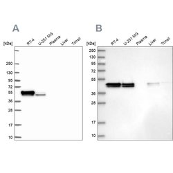 Invitrogen RCN1 Polyclonal Antibody 100 &mu;L; Unconjugated:Antibodies,
