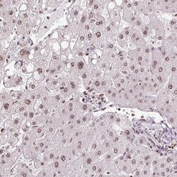 Invitrogen RNF181 Polyclonal Antibody 100 &mu;L; Unconjugated:Antibodies,