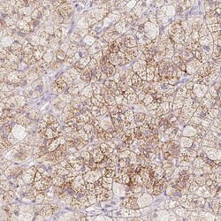 Invitrogen TRPML3 Polyclonal Antibody 100 μL; Unconjugated:Antibodies,