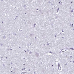 Invitrogen OVGP1 Polyclonal Antibody 100 &mu;L; Unconjugated:Antibodies,