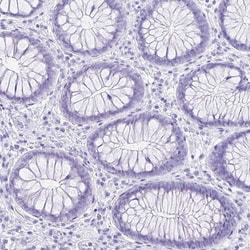 Invitrogen OVGP1 Polyclonal Antibody 100 &mu;L; Unconjugated:Antibodies,